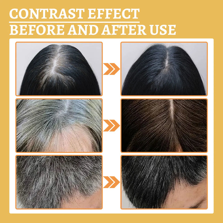 Black Ganoderma Hair Essence – Scalp & Follicle Care