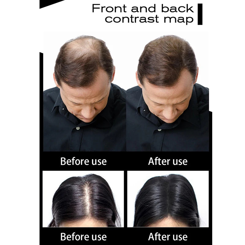 Sevich Hair Fibers 100g – Hair Loss Concealer & Growth Powder