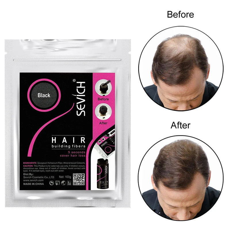 Sevich Hair Fibers 100g – Hair Loss Concealer & Growth Powder