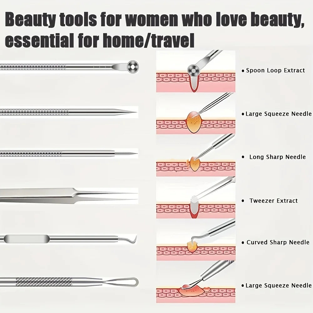 6-Piece Acne & Blackhead Removal Tool Set