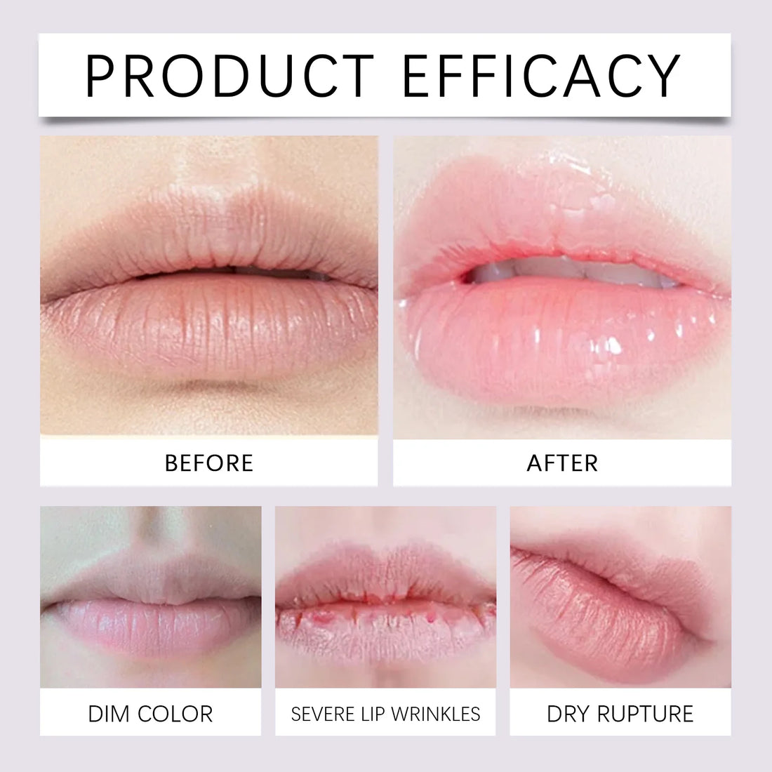 Lip Care Set – Nourishing & Moisturizing Balm Kit