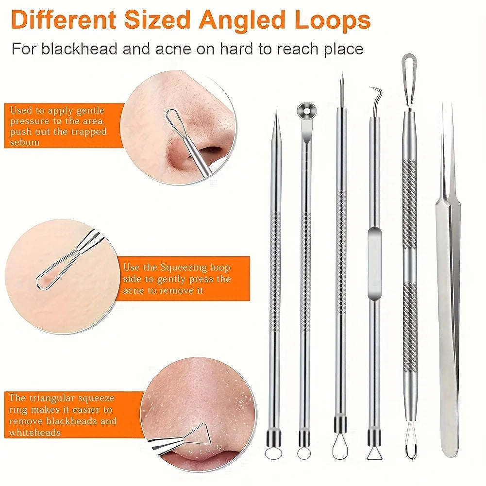 6-Piece Acne & Blackhead Removal Tool Set