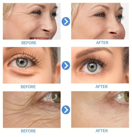 15ml Hyaluronic Acid Collagen Facial Essence – Whitening & Lifting