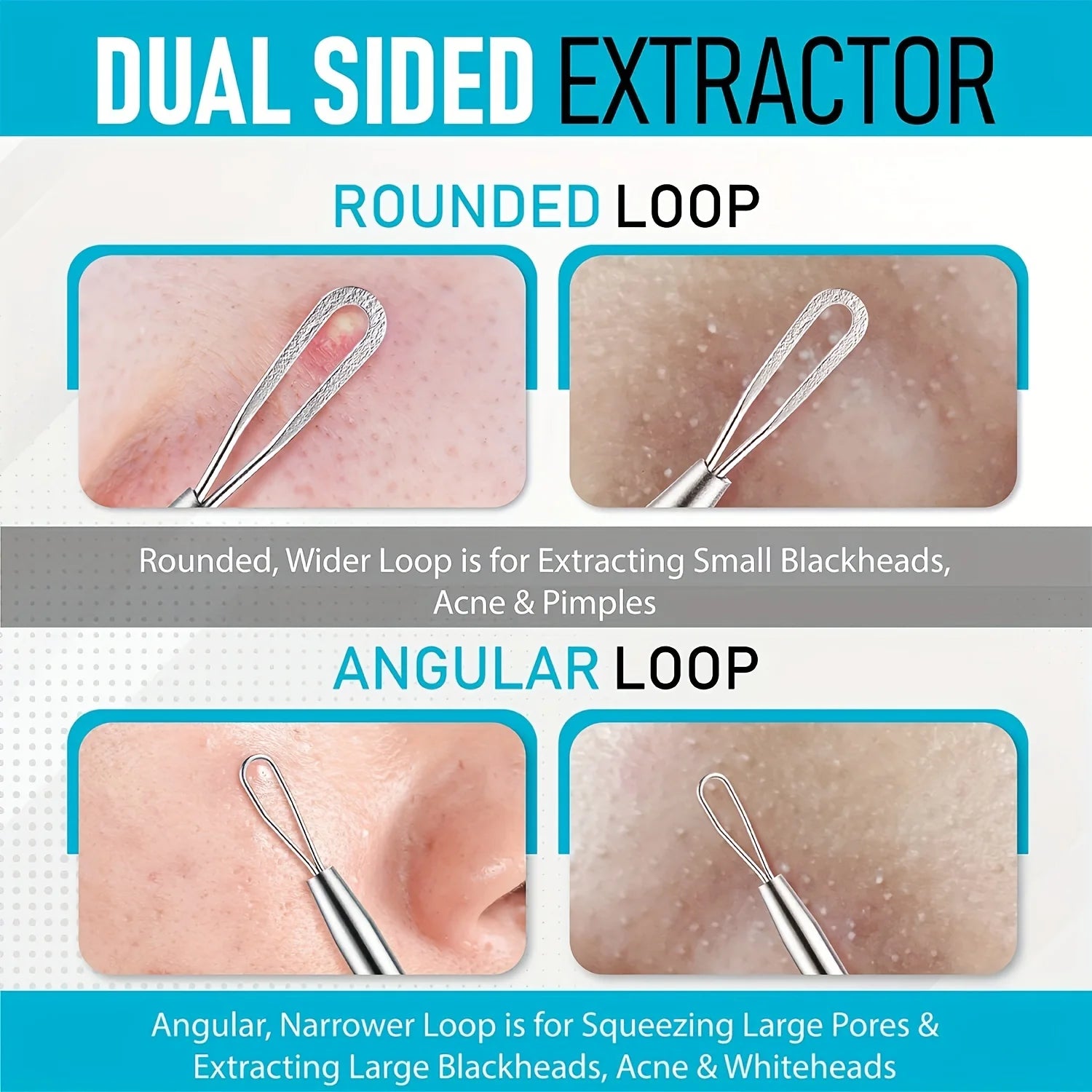 6-Piece Acne & Blackhead Removal Tool Set