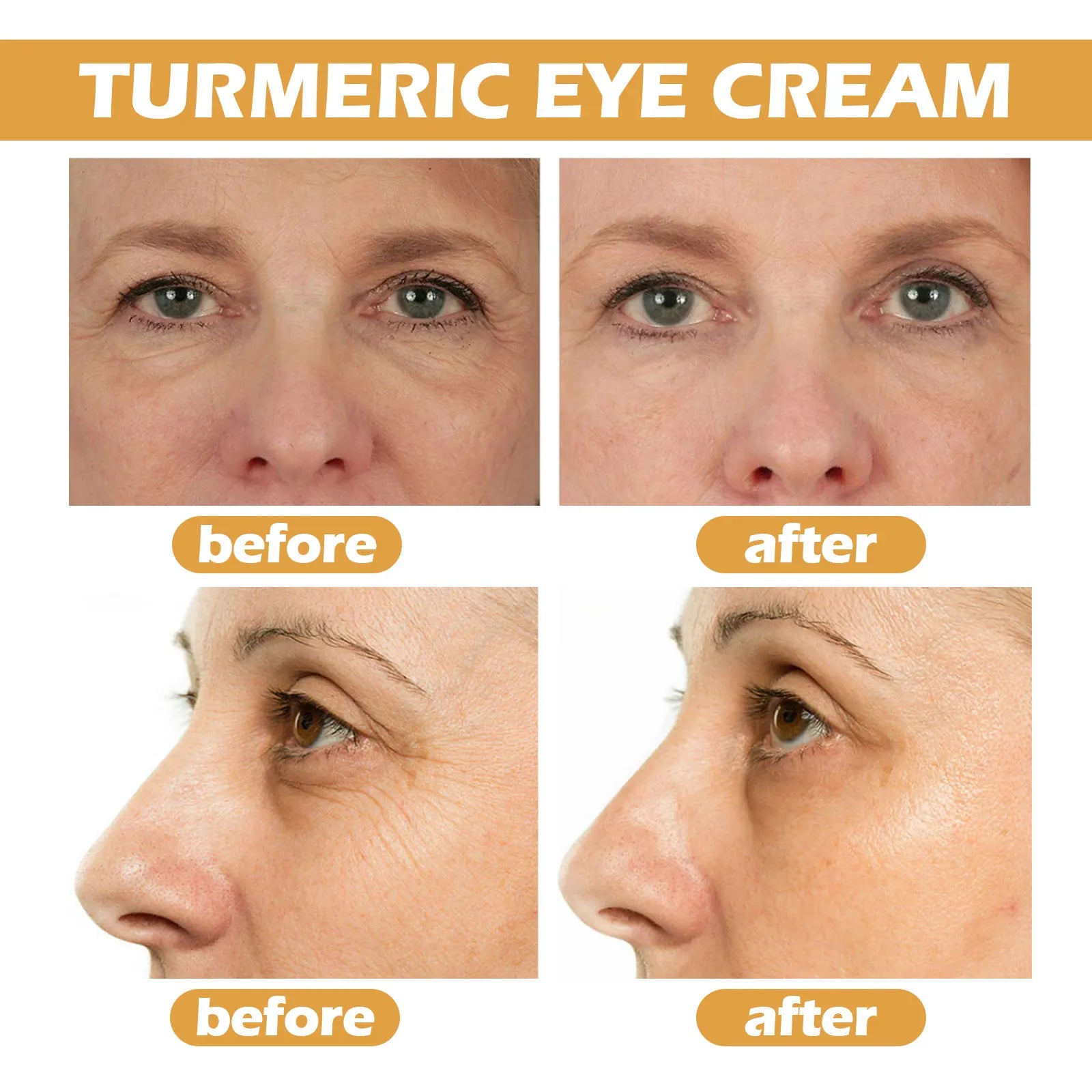 Eelhoe Turmeric Eye Cream – Anti-Wrinkle & Dark Circle Fade