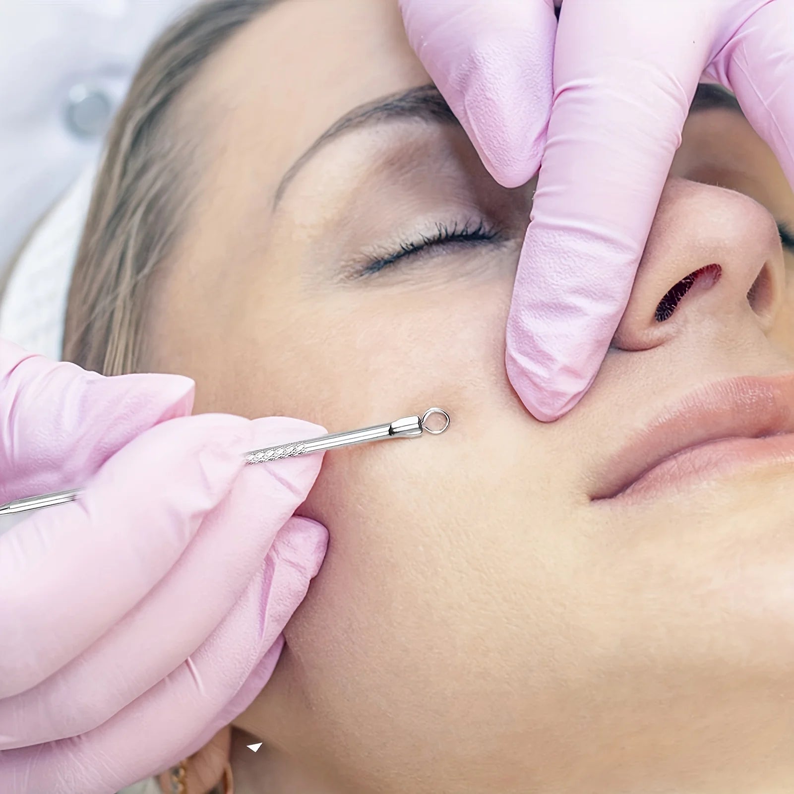 6-Piece Acne & Blackhead Removal Tool Set