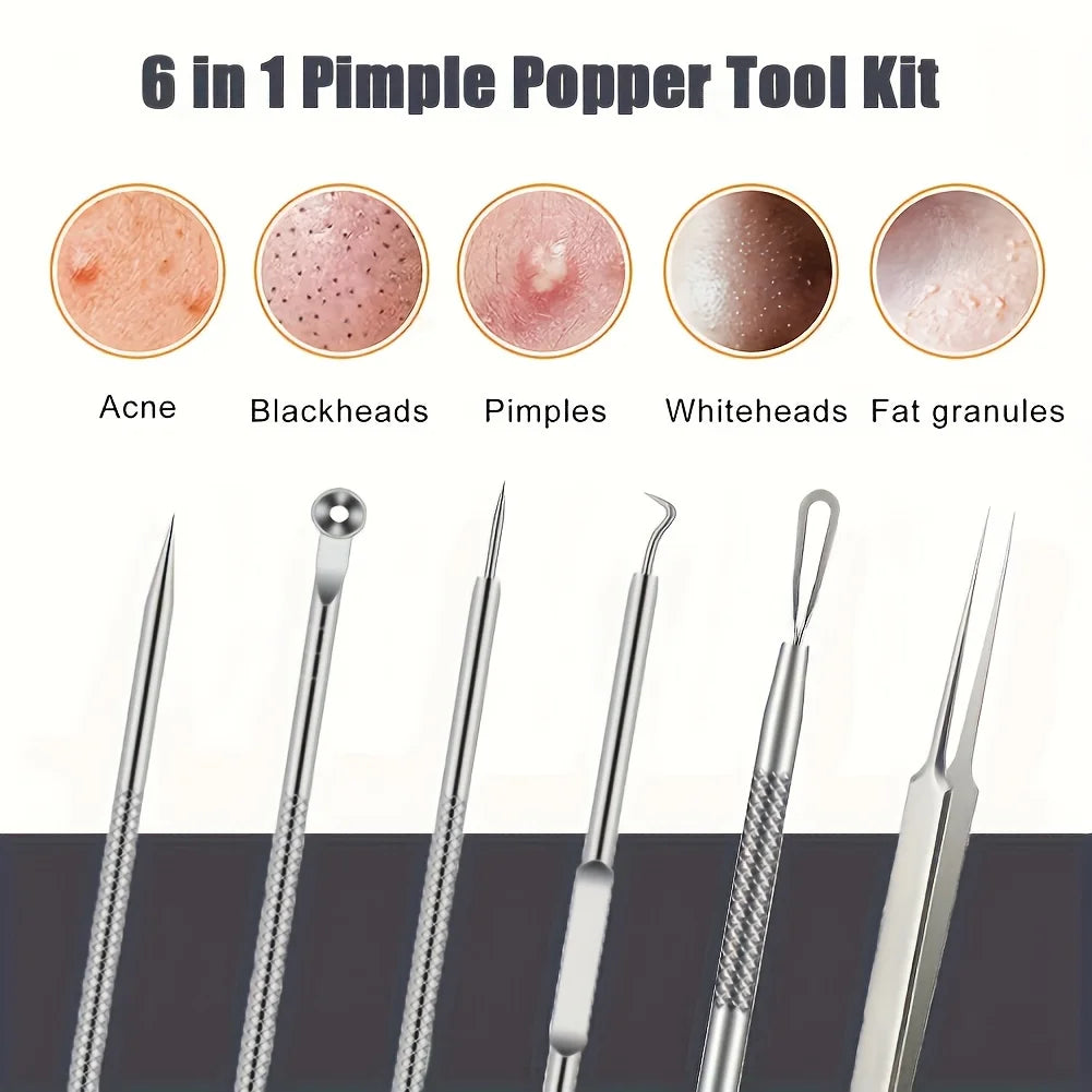 6-Piece Acne & Blackhead Removal Tool Set