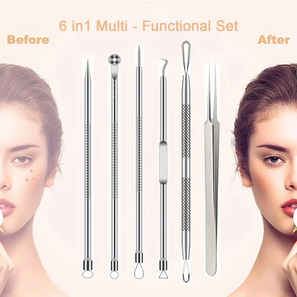 6-Piece Acne & Blackhead Removal Tool Set